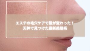 エステの毛穴ケアによる肌の変化を示すビフォーアフター比較画像、天神Radianceの最新美肌術